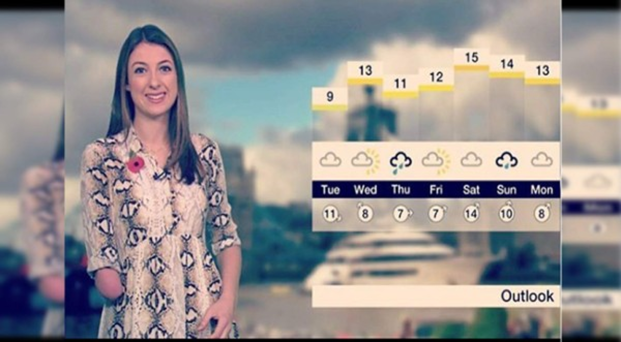 Martin nació sin su antebrazo y mano derecha; sin embargo, esto no le impidió trascender, es la primera presentadora del tiempo de la BBC con discapacidad física.