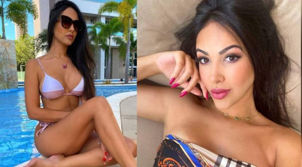 La modelo brasileña Liliane Amorim se sometió a una liposucción y se encontró con la muerte.