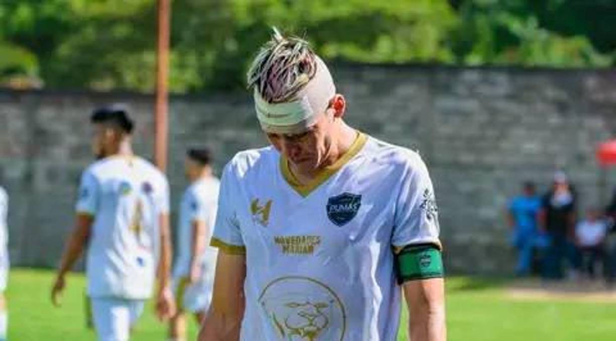 “Aguanté hambre”: declaró Francisco Martínez en charla con Diario LA PRENSA al recordar los momentos complicados que ha tenido que soportar. 