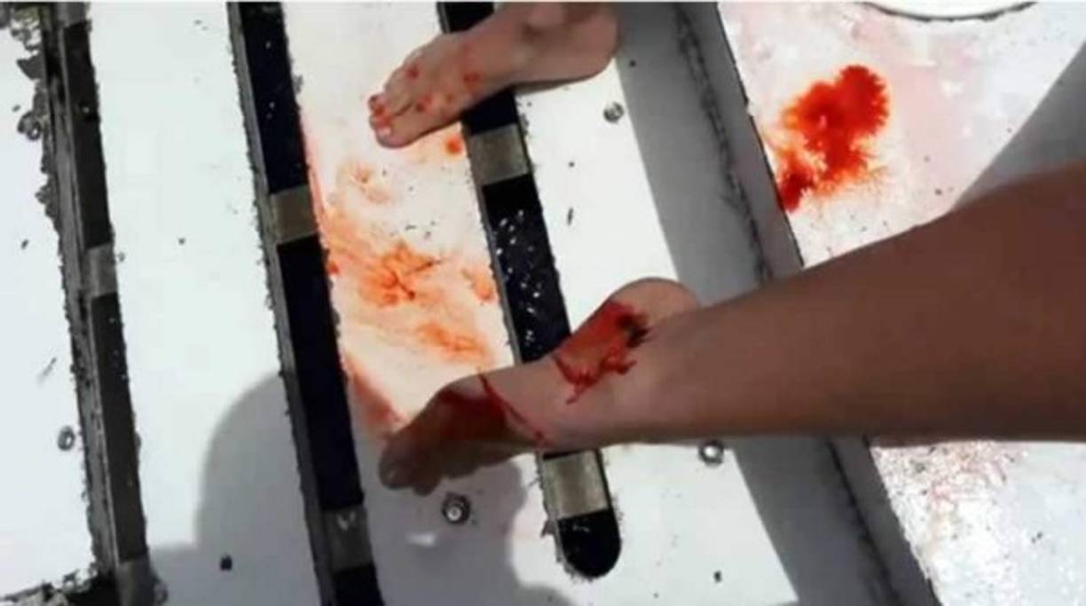 Una vez en cubierta, la actriz mostró una profunda herida en el tobillo, que impactó al resto del equipo. Los gritos comenzaron a sentirse alrededor de ella.