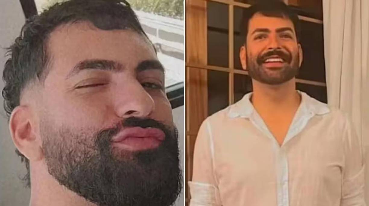 Se ha revelado que Becker completó un curso en línea sobre peeling con fenol impartido por la farmacéutica Daniele Stuart, lo que llevó a la Asociación Nacional de Esteticistas y Cosmetólogas (Anesco) a declarar que no puede ser considerada esteticista calificada para realizar procedimientos invasivos de esta naturaleza.