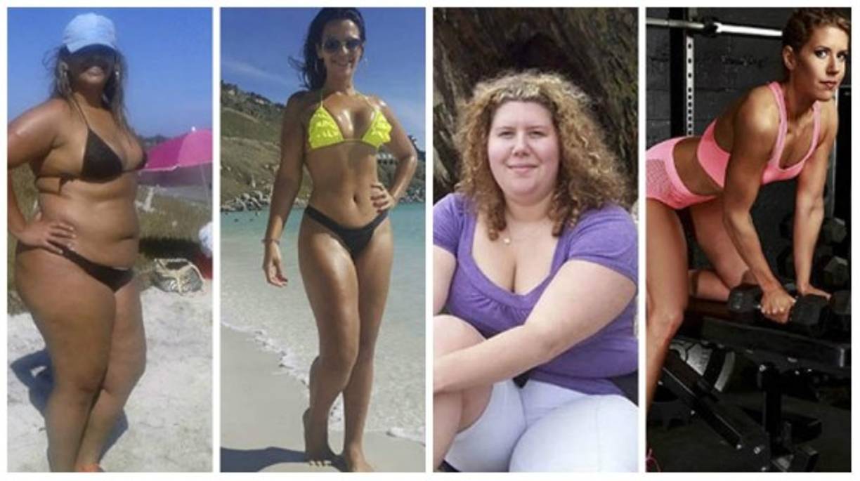 Para quienes están con sobrepeso extremo, también conocidos como obesos mórbidos, la batalla contra los kilos es mucho más dramática. Mira estas imágenes.