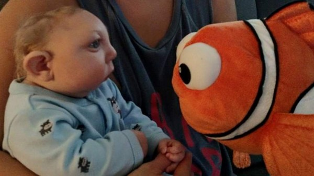 Jaxon fue diagnosticado con anencefalia, una malformación congénita del tubo neural en el que un niño nace sin partes del cerebro y el cráneo. Pero los médicos no estuvieron seguros de la gravedad del mal sino hasta después del nacimiento.