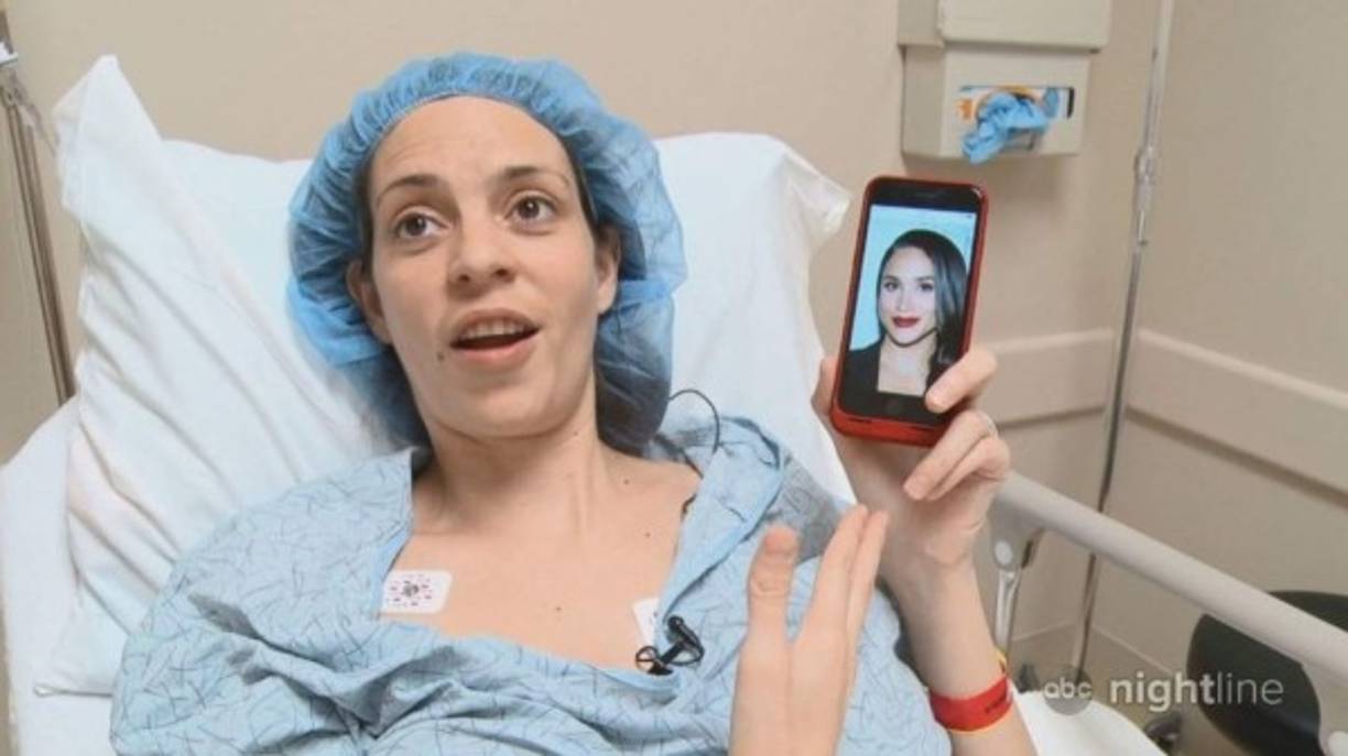 La madre de tres hijos pasó por el quirófano hace cuatro meses para deshacerse del exceso de grasa en el estómago y hacerse una cirugía de nariz, en un intento por parecerse a la duquesa de Sussex.