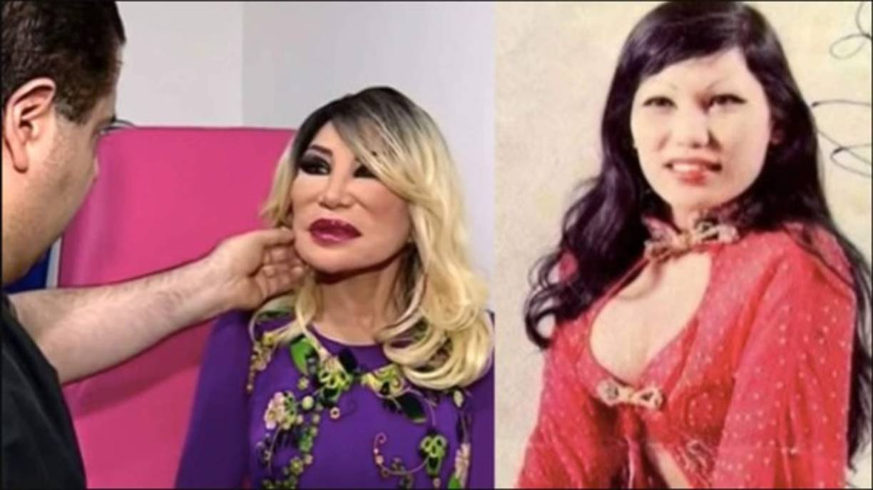 Comparativa del rostro de Lyn May. <br/><br/>Foto: (Telemundo)