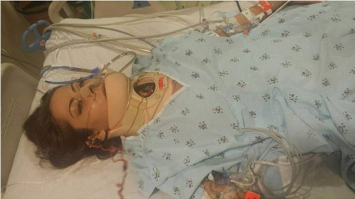 Después de pasar por cuatro cirugías, Madison estuvo nueve meses en recuperación: no podía ingerir alimentos o bebidas directamente, por lo que le insertaron un tubo a través de la cadera y que conectaba con su intestino grueso, ya que su estómago e intestino delgado resultaron desgarrados en el accidente. <br/>