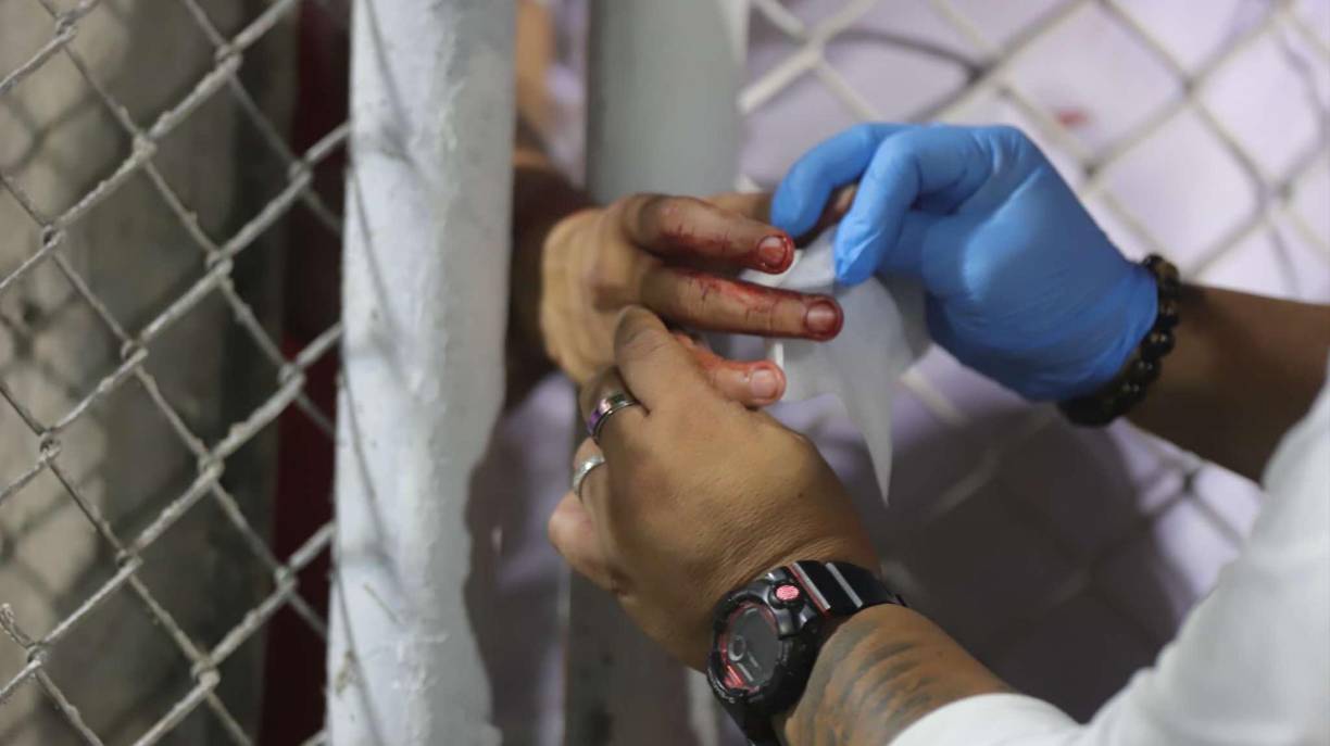 Un aficionado del Olimpia se reportó herido.