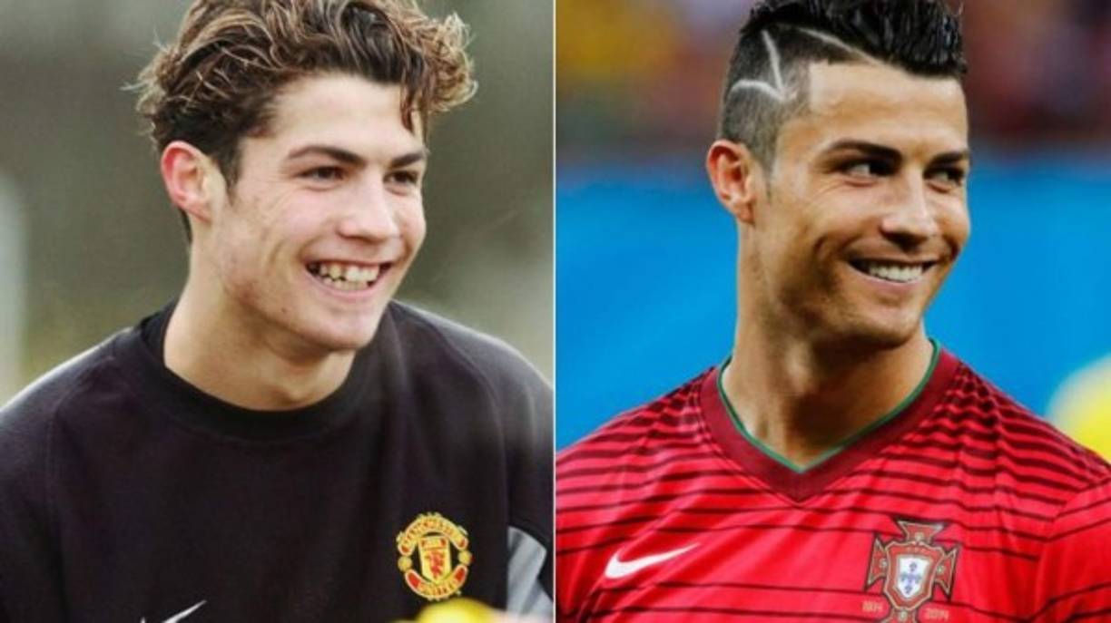 El antes y después de Cristiano Ronaldo es notorio, aunque el jugador nunca se ha pronunciado sobre las cirugías realizadas.