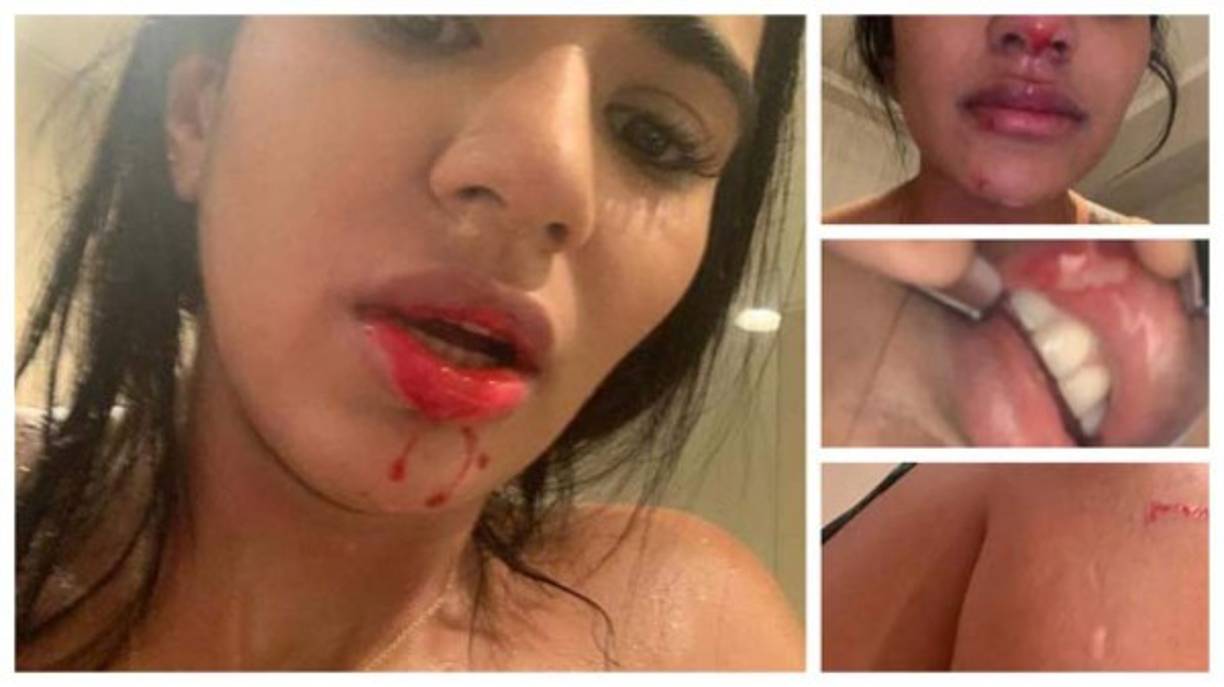 'Es una persona bipolar. Por un momento está feliz y muestra alegría, pero en otro, enojo, es grosero, insulta. Sebastián es una caja de sorpresas porque cambia de actitud constantemente. Lo perdoné muchas veces. Siempre creía que iba a cambiar', dijo la joven.