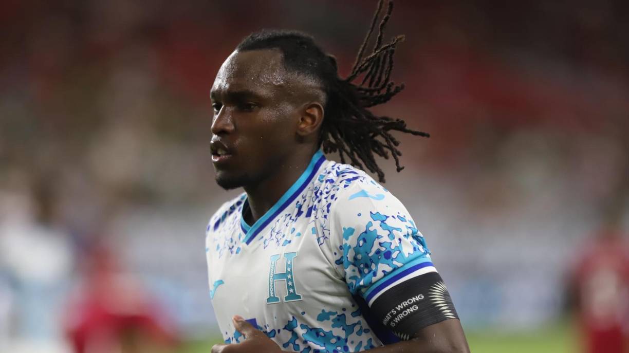 Alberth Elis: El atacante del Bordeaux de Francia es baja por lesión. 