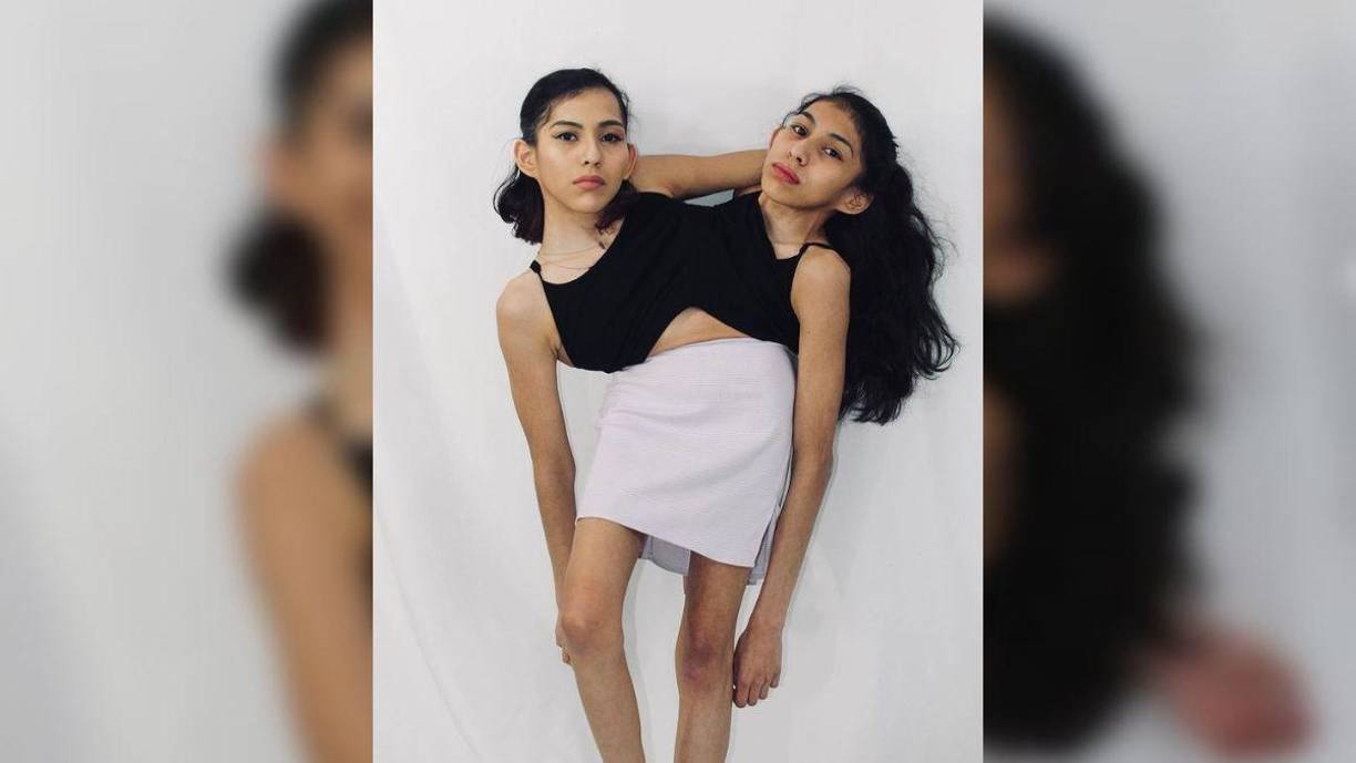 En ocasiones, al final del día, nos sentimos agotadas y preferimos mantener silencio. En esos momentos, utilizamos diferentes dispositivos para cada una hacer lo que deseamos. Al haber estado unidas desde siempre, no extrañamos nuestra independencia, ya que esto es todo lo que hemos conocido, ¿no es así?”, comentó Carmen, quien es más extrovertida de las dos, en una entrevista con ‘Today’.