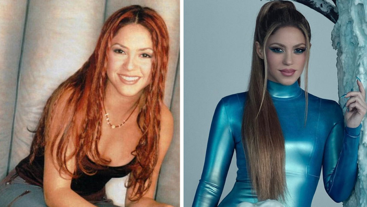 Con el fin de mantener un aspecto juvenil y sin arrugas, Shakira decidió someterse a un estiramiento facial. Este procedimiento busca corregir los signos del envejecimiento, como la tensión de los músculos faciales, la reducción de grasa y la redistribución de la piel. La cantante invirtió alrededor de 2000 euros en esta intervención estética.