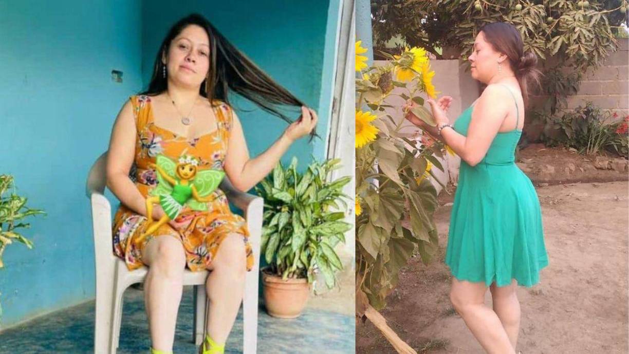 Yadira Córdova está luchando por su vida en el Hospital Escuela luego de ser atacada a balazos en Danlí, El Paraíso.