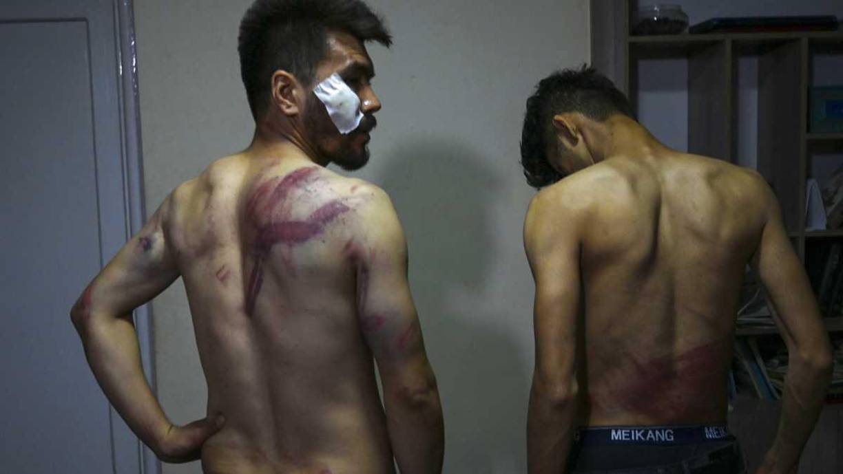 Nematullah fue finalmente llevado a una celda donde se hacinaban unas 15 personas. Se encontró con Taqi, detenido y golpeado de igual manera y en estado de choque, con la cabeza ensangrentada. “Estábamos tumbados en el suelo, me dolía tanto todo que no podía moverme”, dice Taqi.