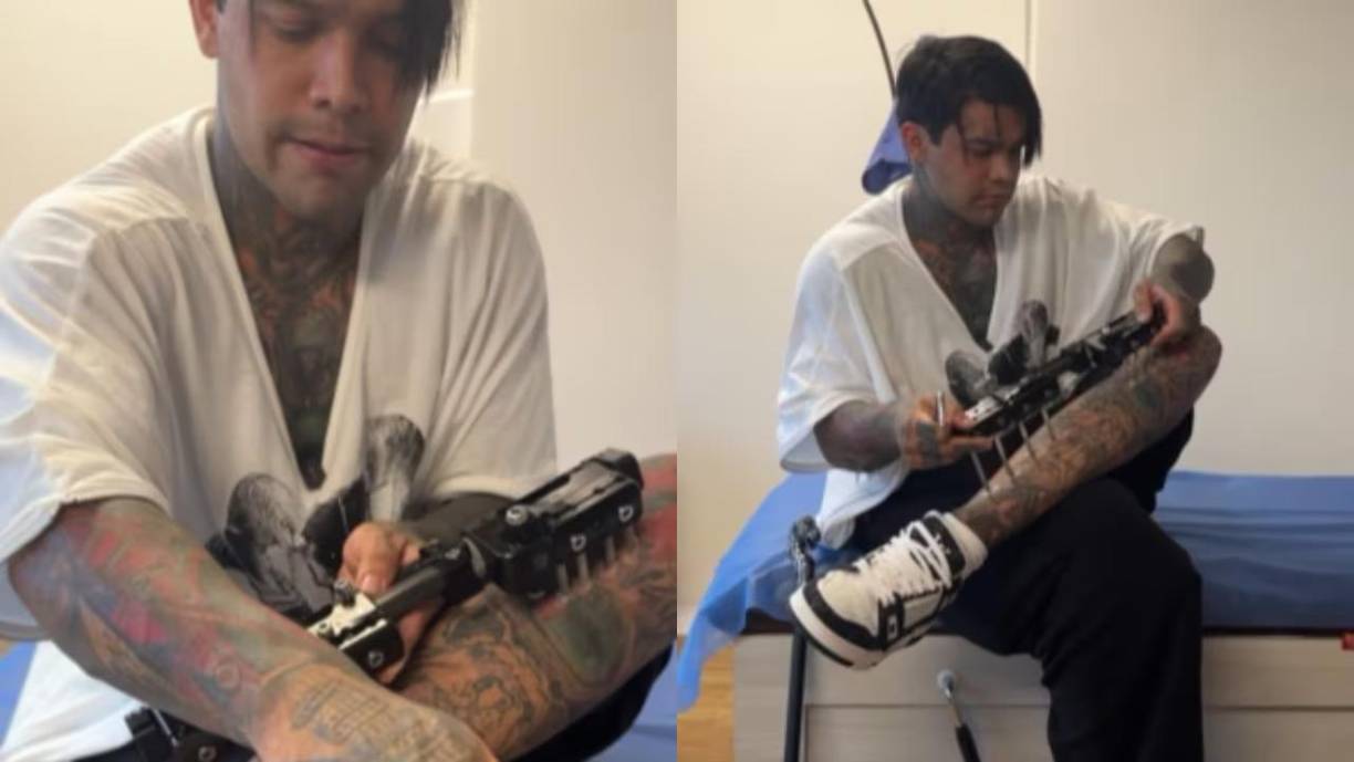 “Yo tuve algo con las piernas que realmente no lo quise decir, porque son temas muy personales [...] Hubo un millón de especulaciones, tipo Illuminati, que realmente no me importaban, que hablen de mí me sirve. Pero la que más me impacto fue el estiramiento de piernas, me puse a investigar, a conocer gente y sí existe...”, agregó a su relato el tiktoker colombiano.