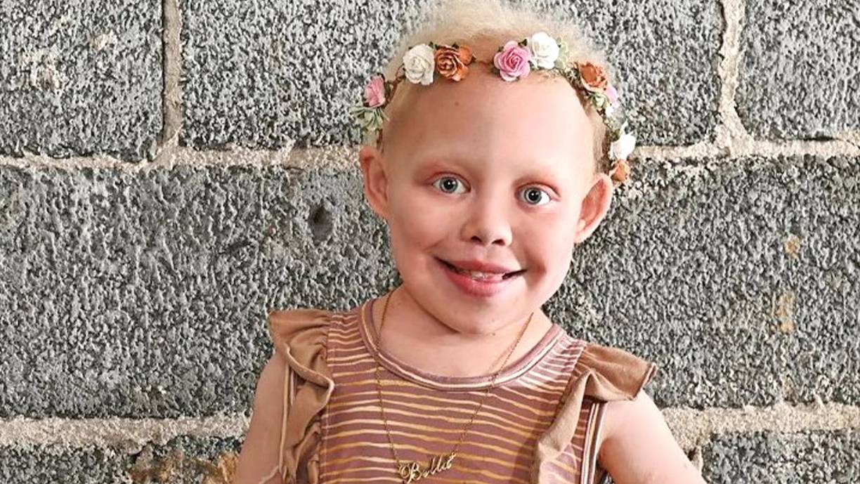 “Se ha producido un rápido deterioro de los pulmones de Bella, parecido a una fibrosis. Creen que podría ser una respuesta inmunitaria”, escribía su madre en redes sociales.