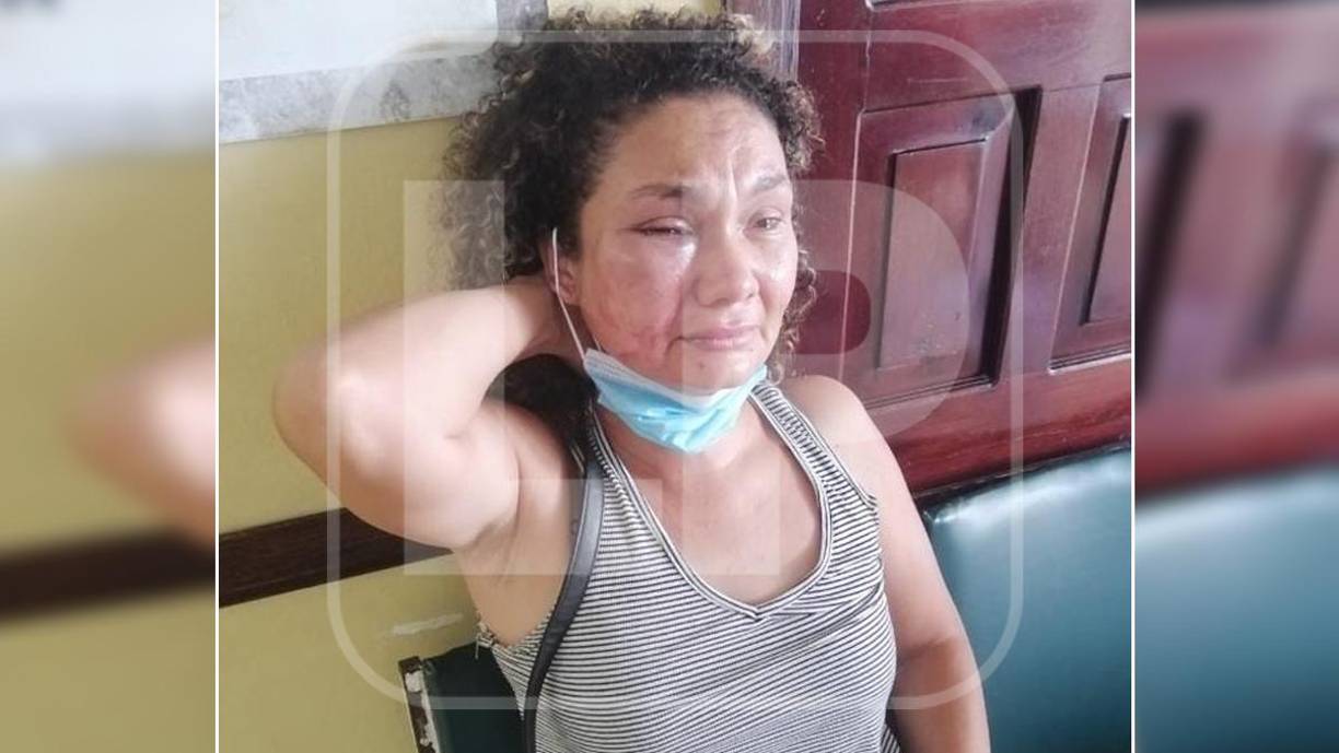 “Hasta el momento creemos que es un tema totalmente pasional, sin embargo esperemos que sean los agentes de investigación que puedan confirmar cuál habría sido la razón por la que se originó esta agresión física”, explicó Sabillón.