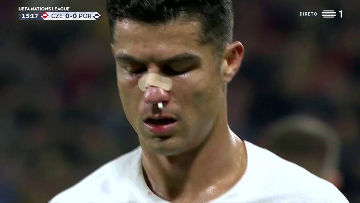 Cristiano Ronaldo pudo levantarse y fue aplaudido por los asistentes en el estadio Eden Arena de Praga, tanto por los aficionados portugueses, como por los checos.