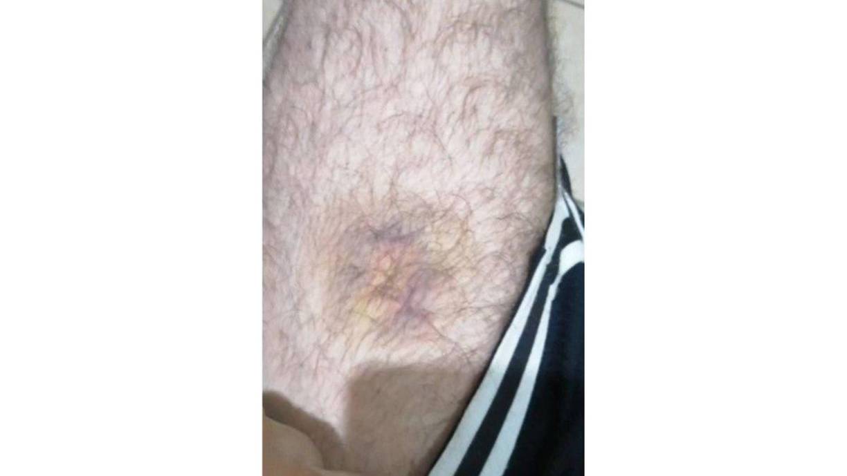 ”Soy Gilbert Reyes, soy ciudadano americano, golpeado físicamente por los policías militares”, dijo Gilbert a través de un video donde mostraba las partes del cuerpo donde fue golpeado.