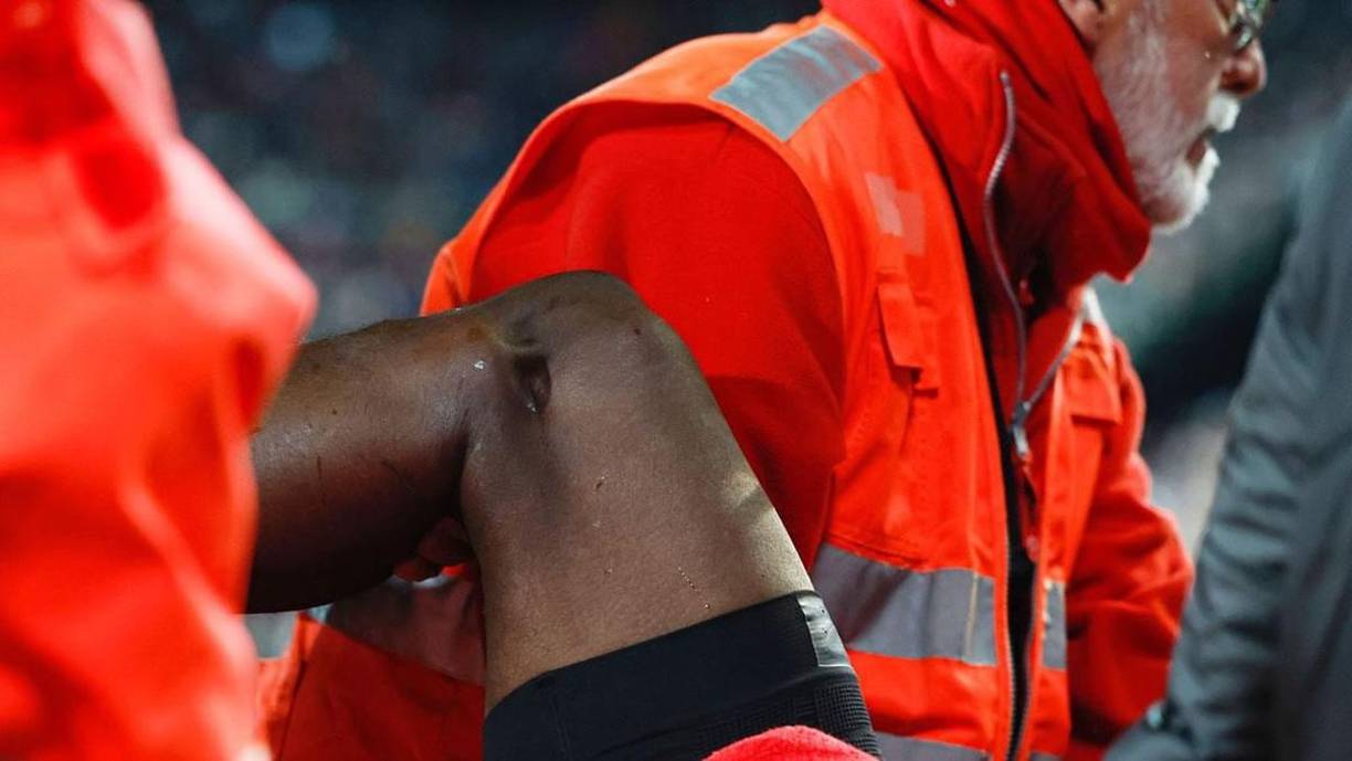 Así quedó la rodilla de Diakhaby tras la terrible lesión en una acción accidental de Tchouaméni. Se lo llevaron en camilla y luego a una clínica.