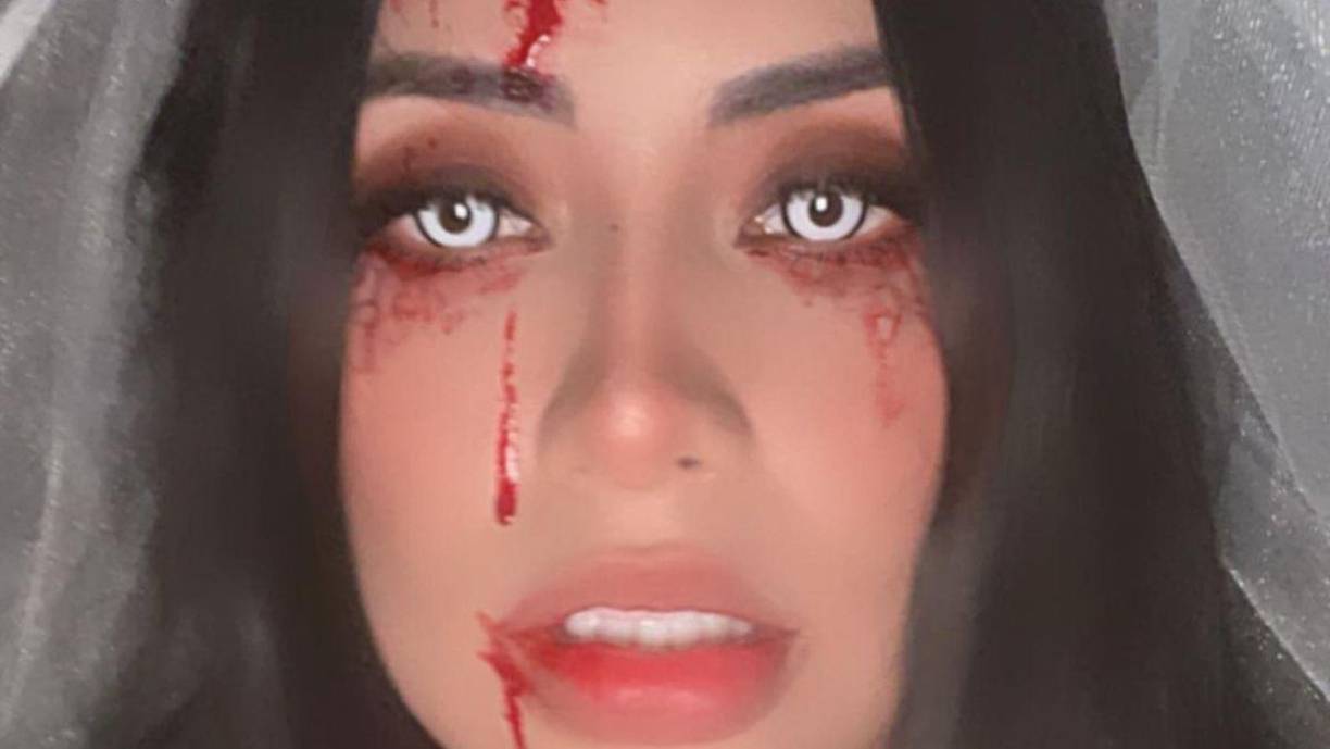 La joven fue traslada hacia el Hospital Mario Catarino Rivas donde recibió atención médica.