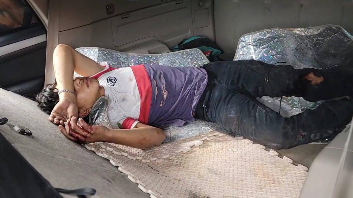 Los jóvenes, que viajaban en una motocicleta, sufrieron múltiples lesiones en distintas partes de sus cuerpos a raíz del impacto.