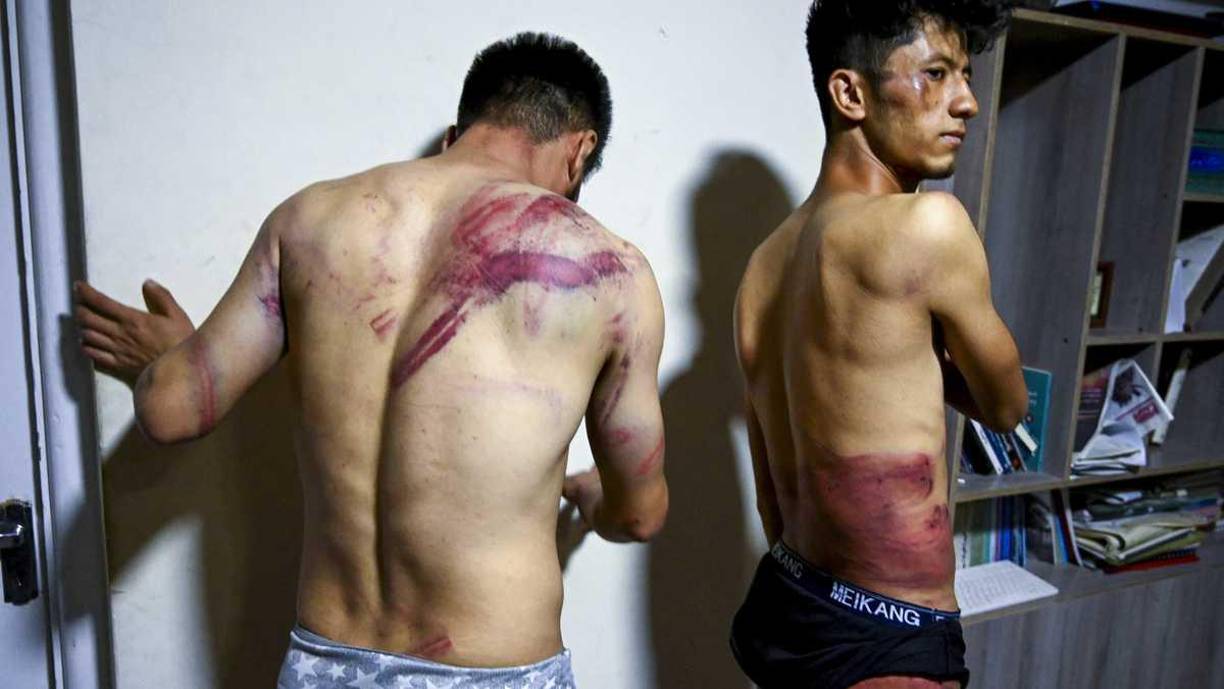 Los talibanes intentaron arrebatar la cámara de Nematullah, él logró escapar y dársela discretamente a una manifestante. Pero los talibanes lo persiguieron y lo llevaron a la fuerza a la comisaría.