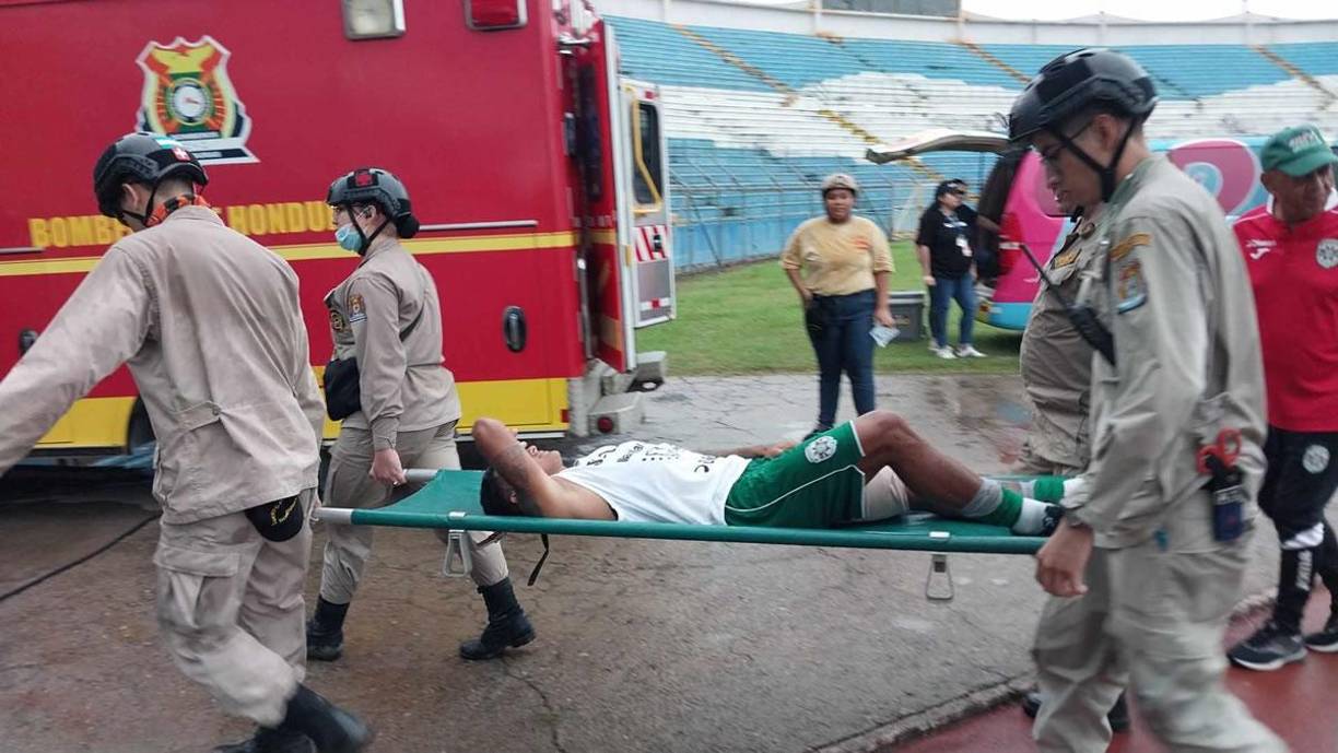 Iván ‘Chino’ López fue retirado en camilla tras salir lesionado en los primeros minutos del partido.