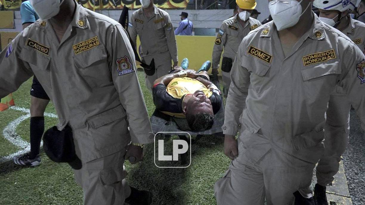 Omar Rosas fue sacado del campo en camilla y con gestos de mucho dolor en su brazo derecho.