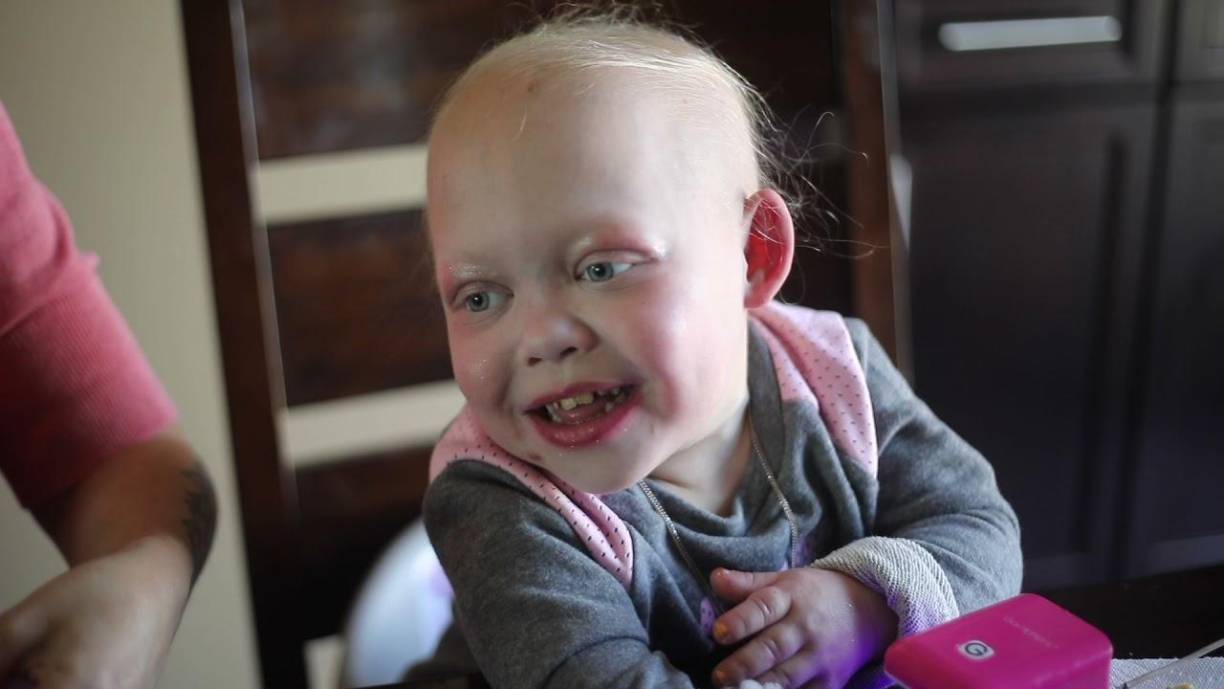 El estado de salud de Bella empeoró a principios de julio y hace unos días tuvo que ser ingresada en la UCI del hospital SickKids de Toronto (Canadá), a causa de una infección pulmonar que obligó a intubarla. 