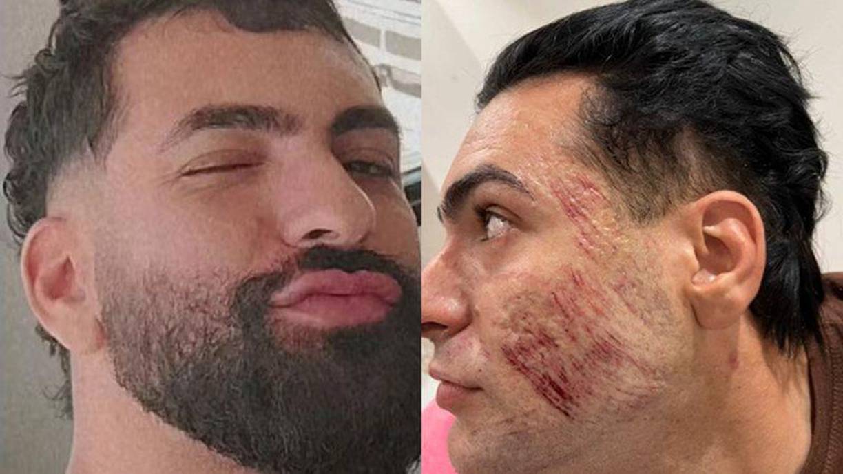 La influencer brasileña Natalia Becker, cuyo verdadero nombre es Natalia Fabiana de Freitas Antonio, ha sido imputada por homicidio con dolo eventual tras la trágica muerte del empresario Henrique Silva Chagas, de 27 años. 