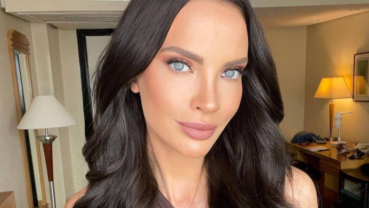 “Querida Kate, te deseo una pronta recuperación. Sé lo molesta que estás, pero así la vida. Espero que sigas brillando y que todos vean tu belleza en Miss Universo 2023”, comentó.