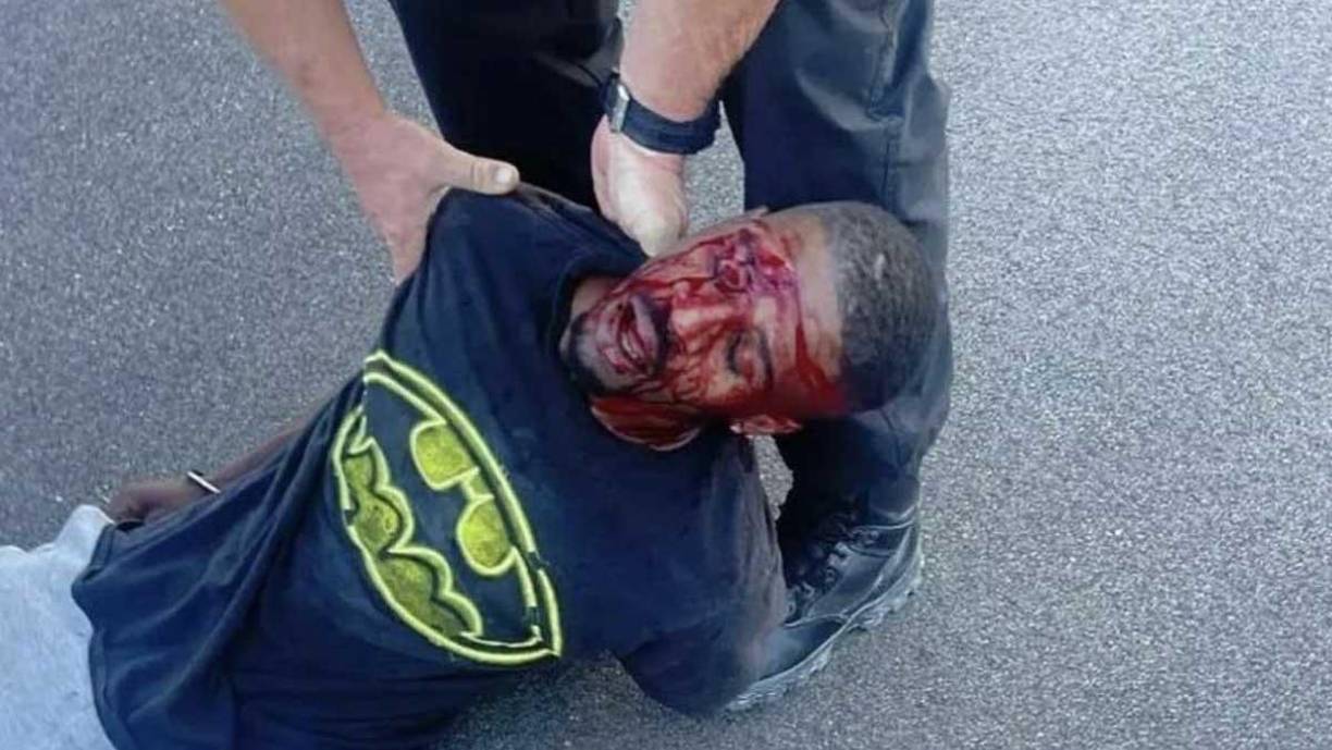 Brandon Calloway resultó herido en el enfrentamiento cuando la policía entró en la casa, pateó dos puertas y usó una pistola Taser y una porra para detenerlo.