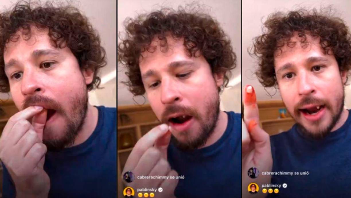 Durante la transmisión, el influencer mexicano dijo que tenía dolor en la mandíbula, desencadenando la preocupación de sus seguidores al retirarse abruptamente al baño. 