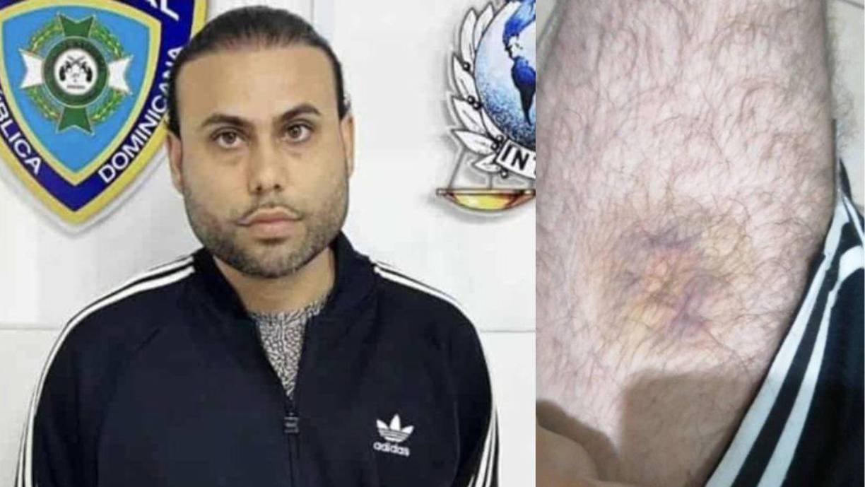 Gilbert Reyes, estadounidense preso en Honduras por un triple feminicidio, fue uno de los varios reos que recibieron una brutal golpiza por parte de miembros de la Policía Militar.