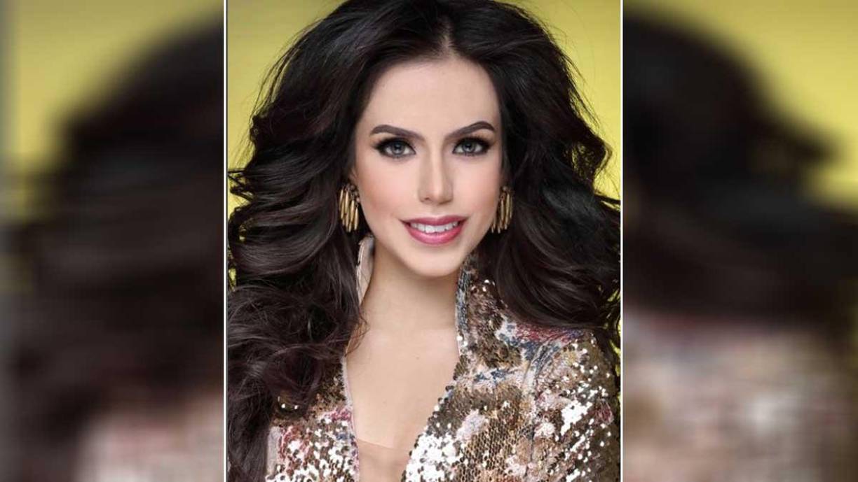 Fuentes ministeriales confirmaron que uno de los disparos que sufrió la artista fue en la cabeza, de entrada por salida.