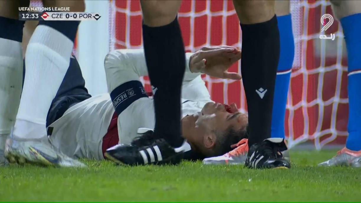 Lo ocurrido generó una seria preocupación en el técnico Fernando Santos, quien conversaba con sus ayudantes para ver si tomaba la decisión de cambiarlo o esperar por una recuperación inmediata. 