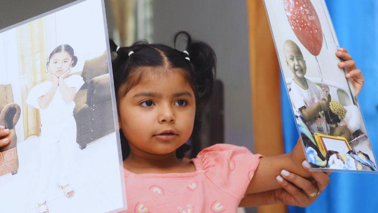 El triunfo de la pequeña Valery Michelle Martínez Lazo sobre la leucemia. Sus dos fotos, la del antes y el ahora resumen así su triunfo sobre una enfermedad de la que cada año se diagnostican 400 nuevos casos solo en la Fundación Hondureña para el Niño con Cáncer.