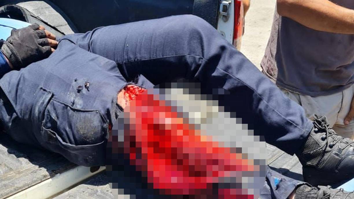 Uno de los policías que resultó herido.