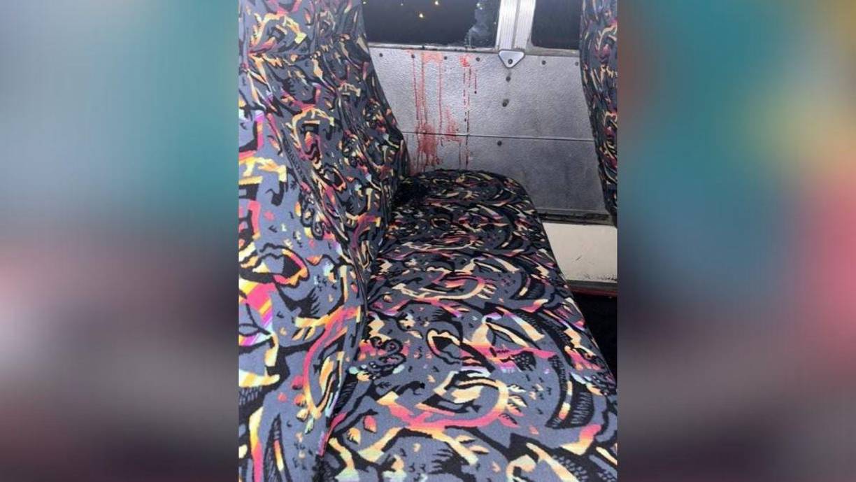 Las víctimas, aficionadas del Marathón, fueron heridas de bala durante un ataque armado al autobús en el que retornaban de Tegucigalpa hacia San Pedro Sula, norte del país, donde tiene su sede el club, dijo a periodistas el portavoz de la Policía Nacional de Honduras, Edgardo Barahona.