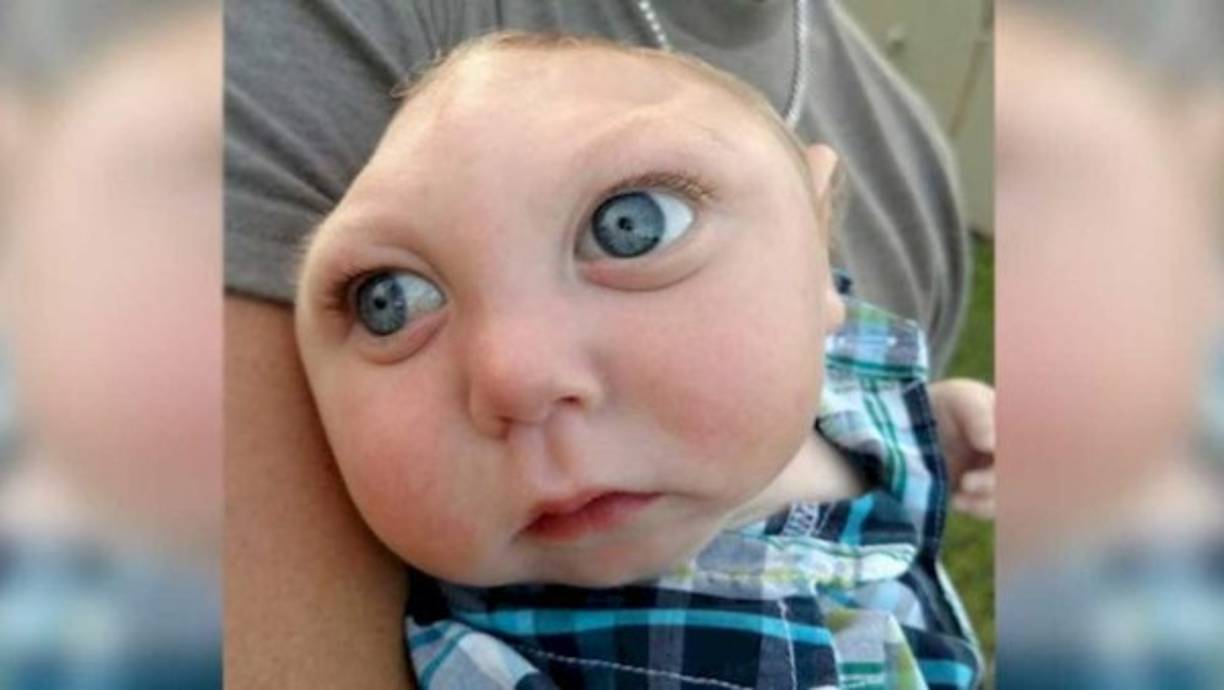 Jaxon Buell cumplió su primer año de edad y se hizo famoso en Facebook por su apodo: 'Strong' (fuerte).