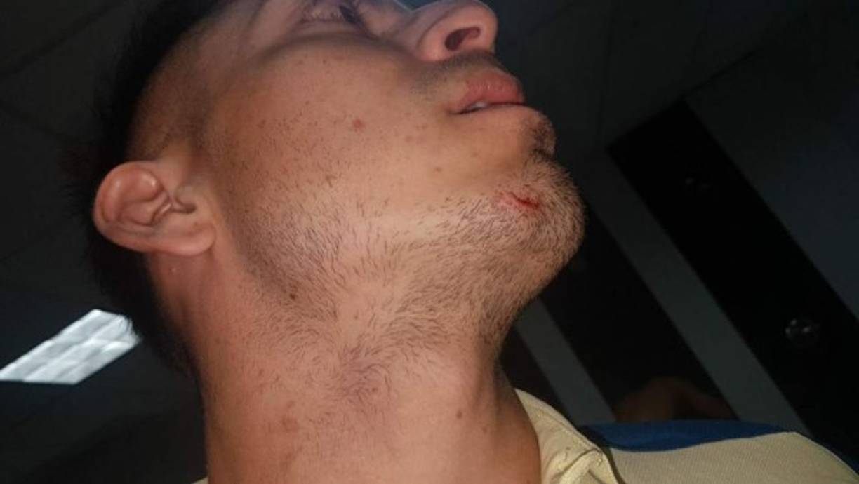 Cuatros jugadores del Alianza resultaron heridos luego del ataque.