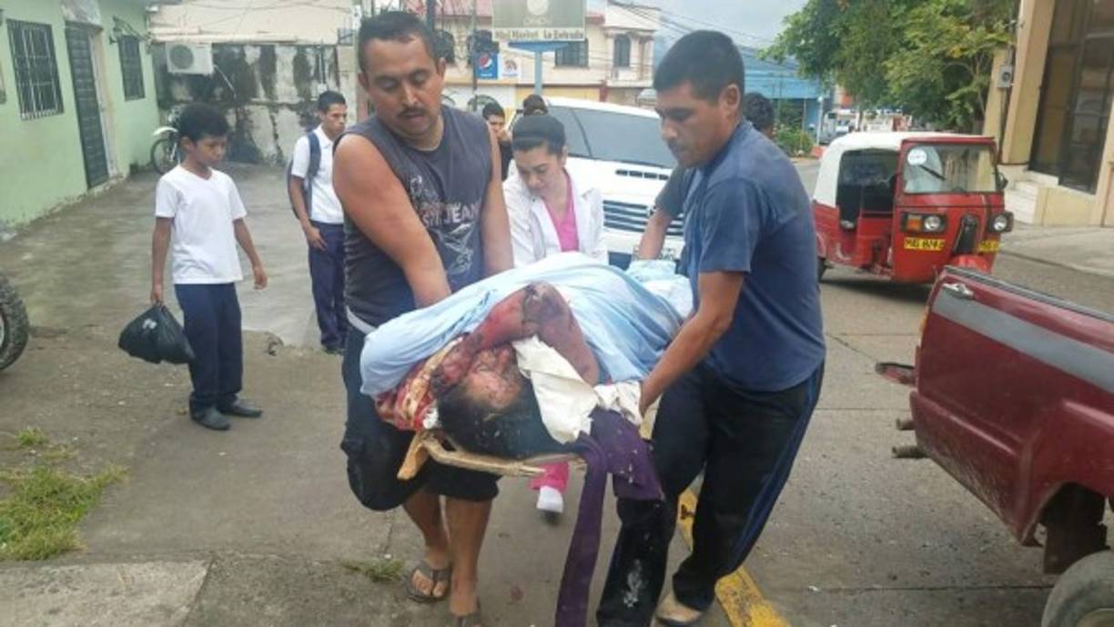 Personal médico indicó que las personas heridas se encuentran muy graves y que su pronóstico es reservado.