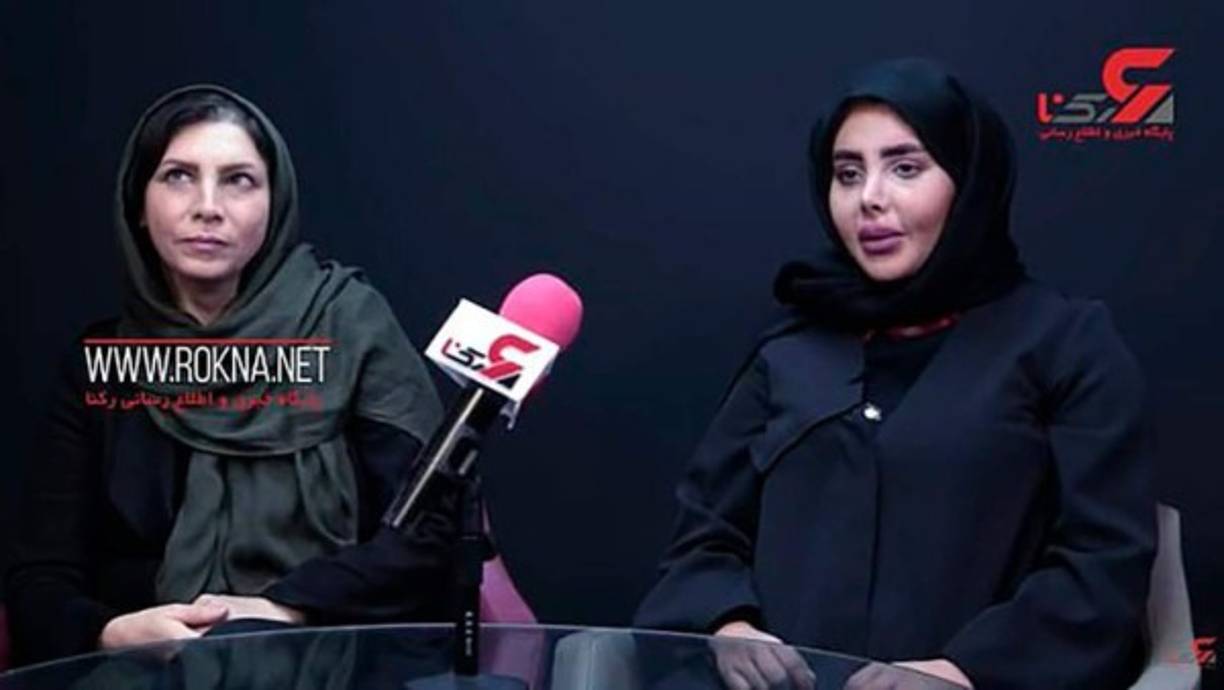 Sahar Tabar reveló que las imágenes que publicó en redes sociales estaban editadas.