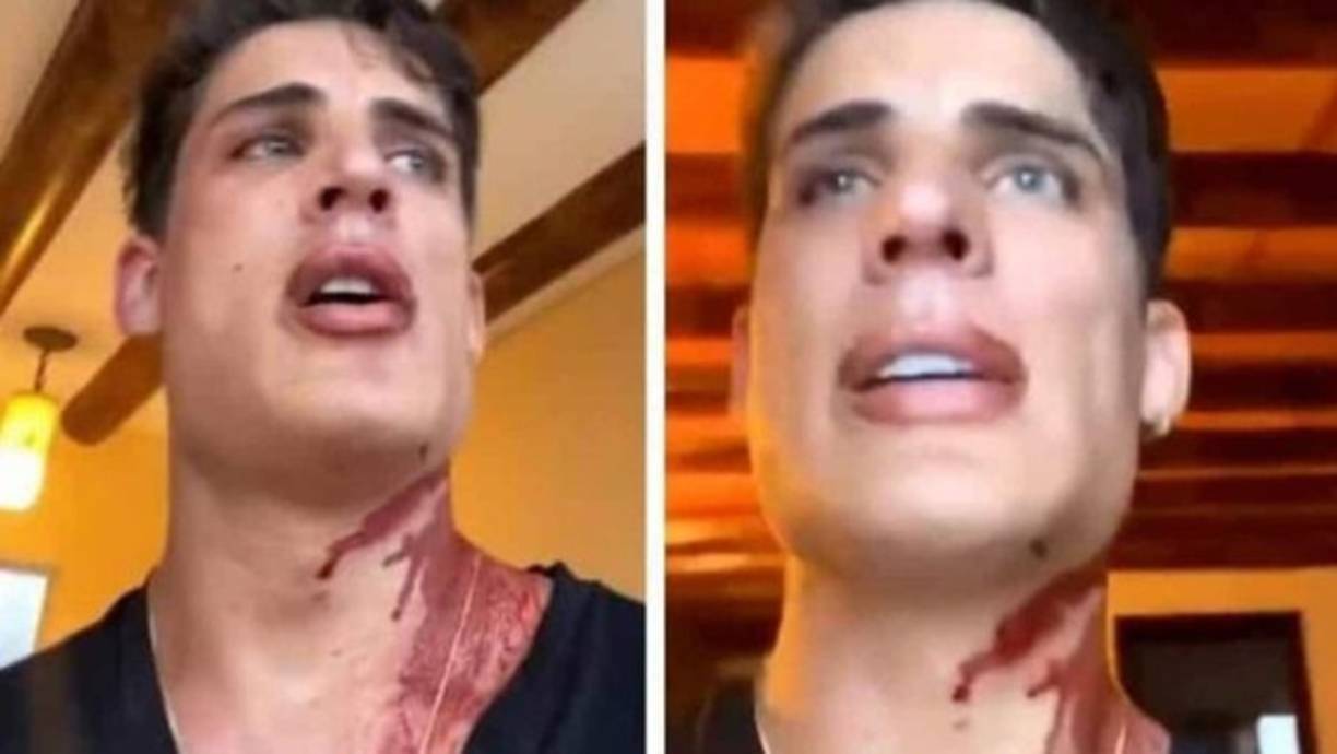 A través de Instagram, el modelo y gamer brasileño publicó un video en el que aparece con el cuello ensangrentado, minutos después del ataque. Según su versión, él ordenó un platillo al mesero, y sin ningún motivo, un hombre le acuchilló.