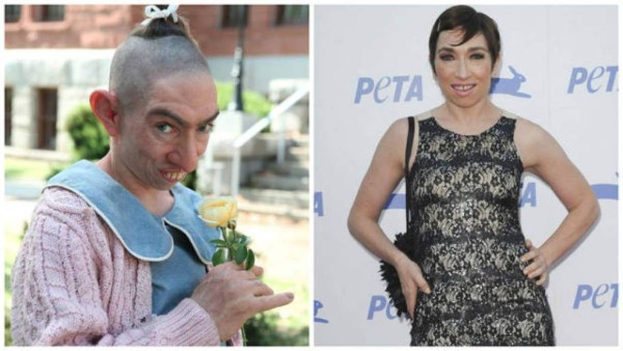 Naomi Grossman se hizo famosa por interpretar a Pepper en American Horror Story.