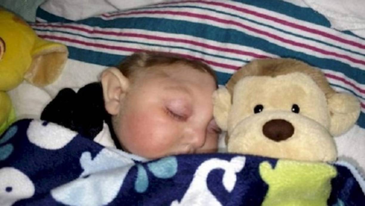 Nació sin la mayor parte de su cerebro y cráneo. No esperaban que viviera, pero ya cumplió un año de vida. Es un verdadero milagro de Dios, dicen sus padres.