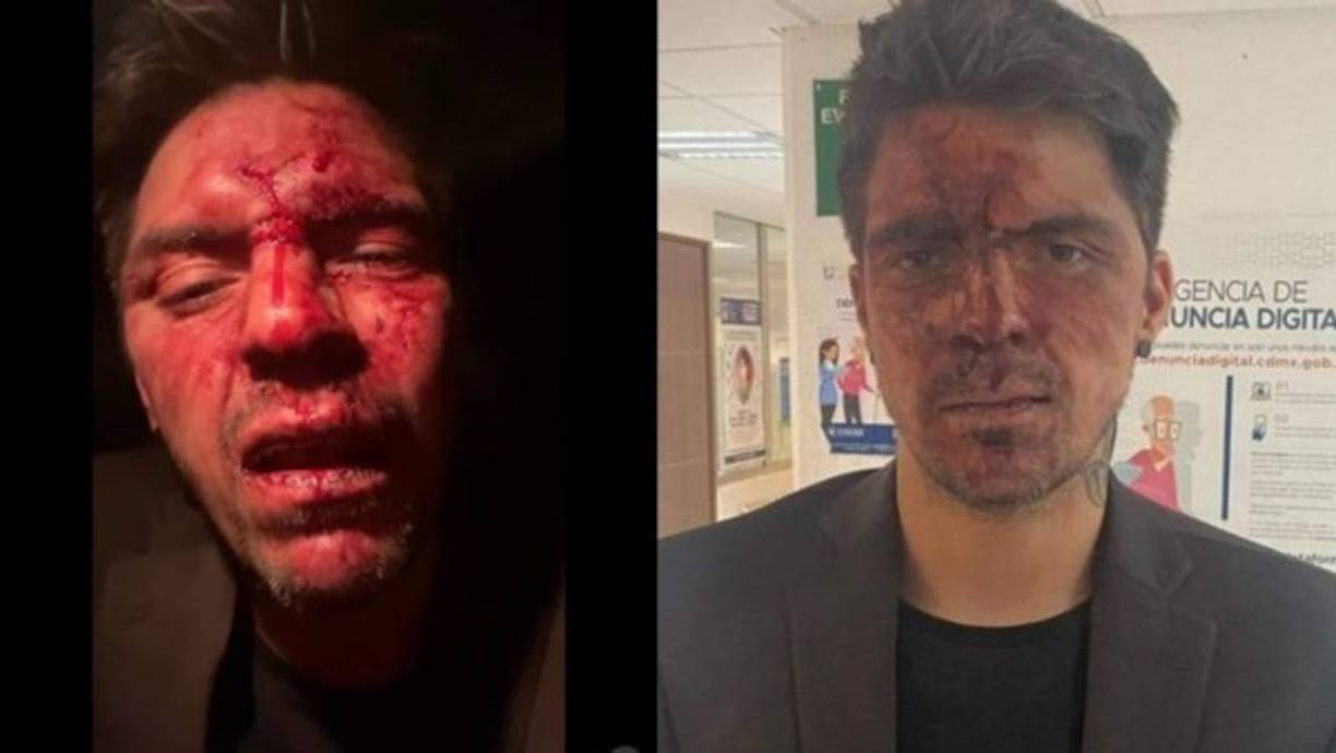 Según la informante, César fue brutalmente golpeado y que incluso, su familia tenía temor de que tenga secuelas como daños cerebrales, por lo que de inmediato le realizaron varios estudios y por fortuna, en los primeros resultados todo salió en orden.<br/>