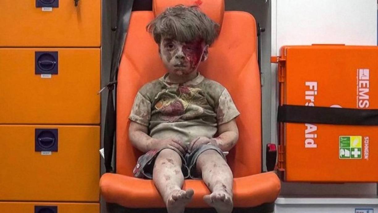 Omran Daqneesh, el niño de 5 años que sobrevivió a un bombardeo en Siria, se convirtió en el símbolo de la guerra en ese país luego de que se viralizara esta imagen en las redes sociales.