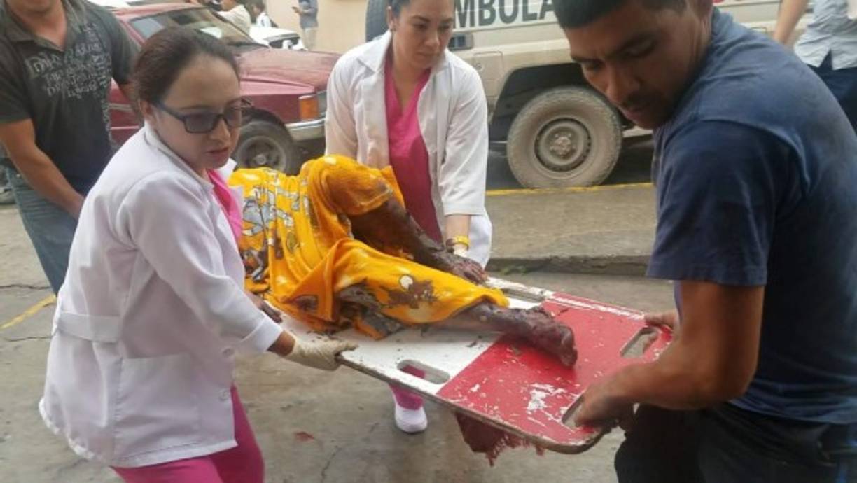 Las víctimas fueron trasladadas por personal de la Cruz Roja al hospital de occidente en Santa Rosa de Copán.